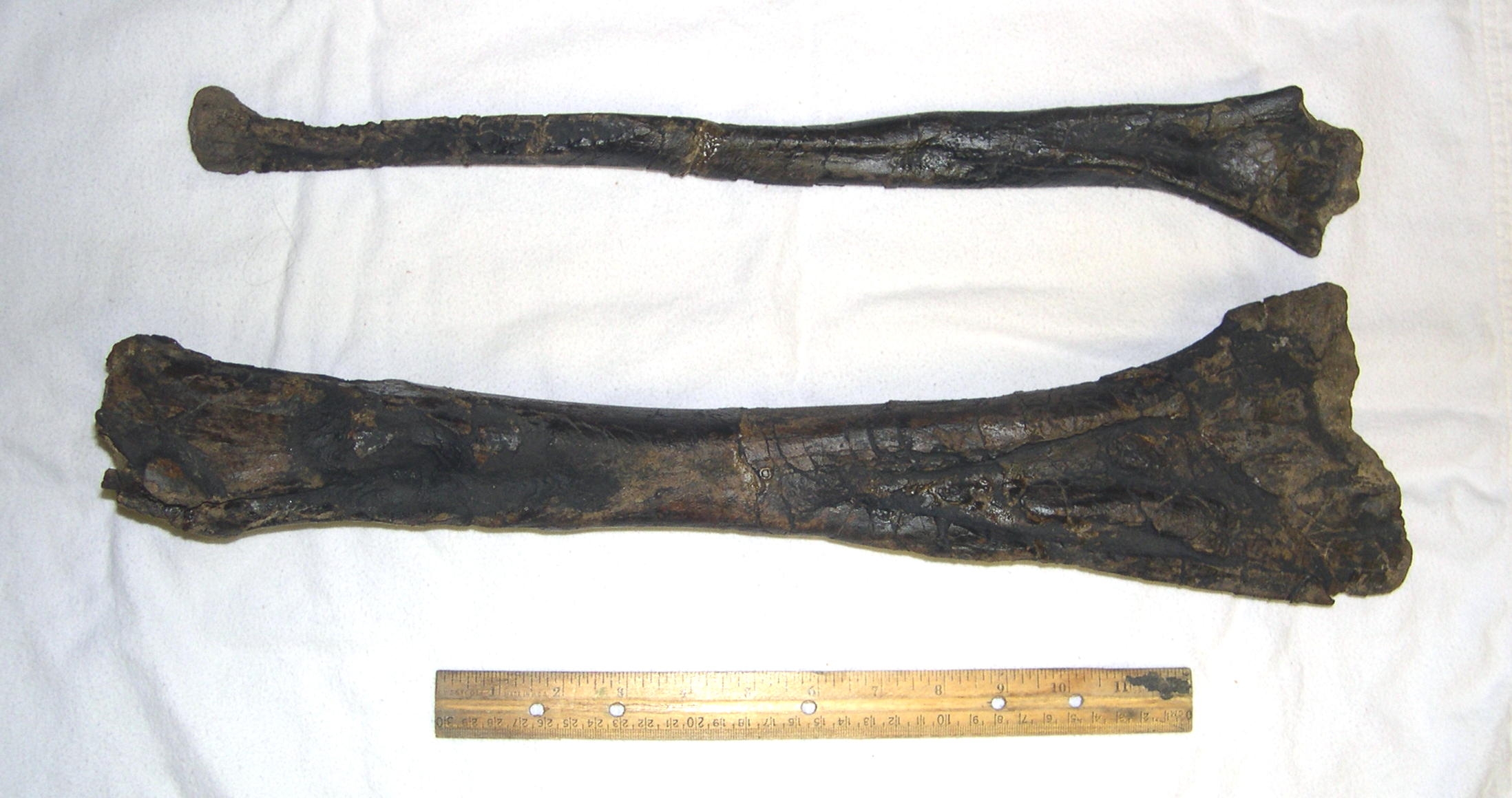 Campto Tibia and Fibula